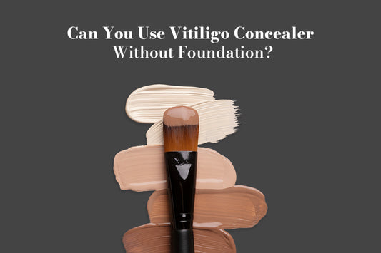 Can You Use Vitiligo Concealer Without Foundation?