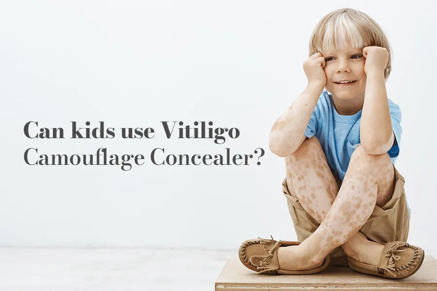 Can Kids Use Vitiligo Camouflage Concealer? – Darclore