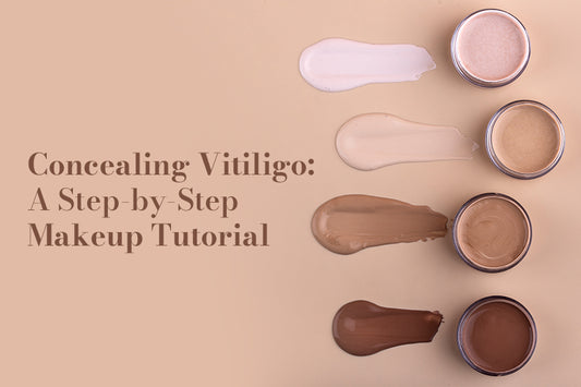 Concealing Vitiligo: A Step-by-Step Makeup Tutorial